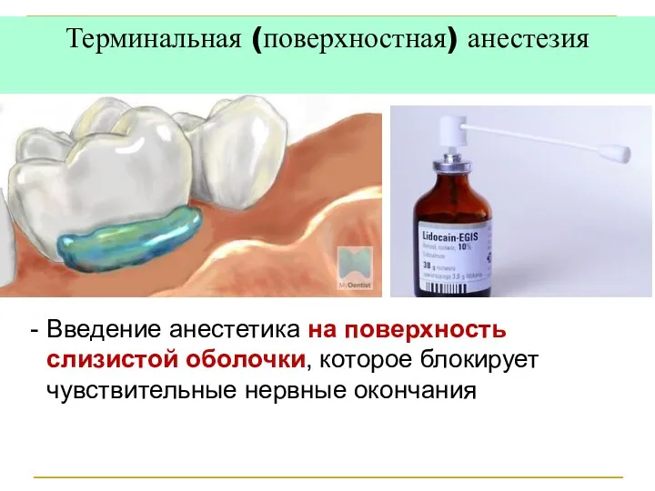 Терминальная (поверхностная) анестезия Введение анестетика на поверхность слизистой оболочки, которое блокирует чувствительные нервные окончания