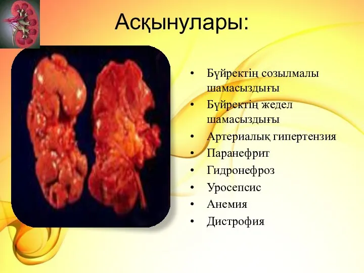 Асқынулары: Бүйректің созылмалы шамасыздығы Бүйректің жедел шамасыздығы Артериалық гипертензия Паранефрит Гидронефроз Уросепсис Анемия Дистрофия