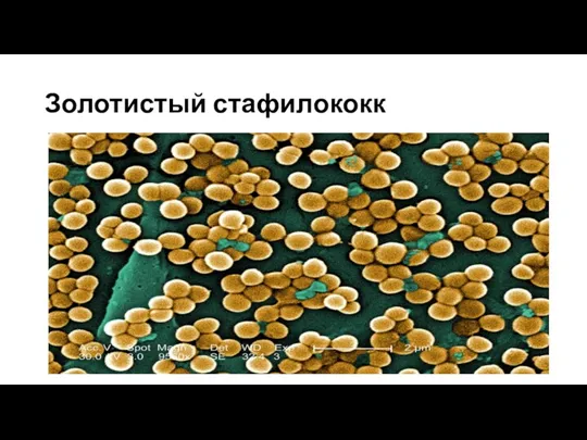 Золотистый стафилококк