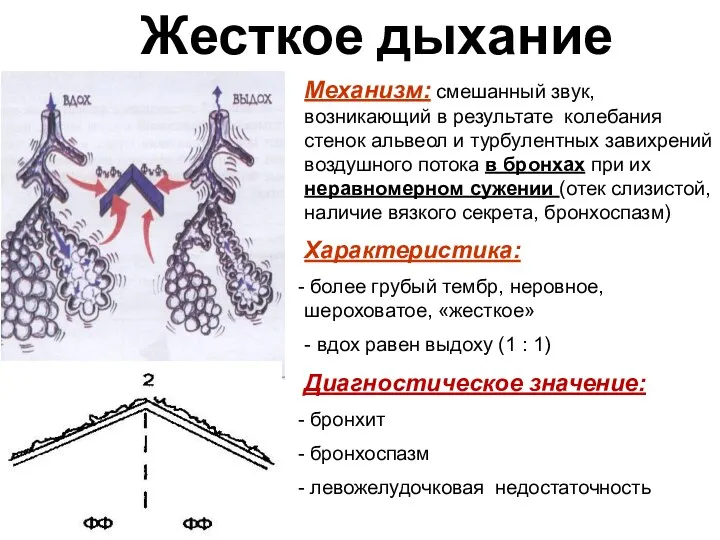 Жесткое дыхание Механизм: смешанный звук, возникающий в результате колебания стенок