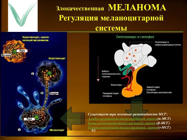 Злокачественная МЕЛАНОМА Регуляция меланоцитарной системы Существует три основные разновидности МСГ: Альфа-меланоцитстимулирующий гормон(α-МСГ) Бета-меланоцитстимулирующий