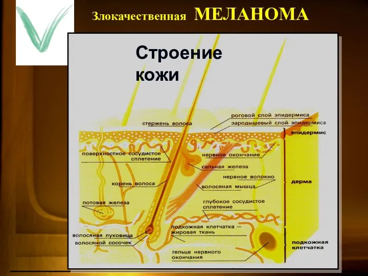 Злокачественная МЕЛАНОМА Строение кожи