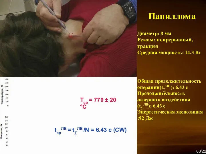 Диаметр: 8 мм Режим: непрерывный, тракция Средняя мощность: 14.3 Вт