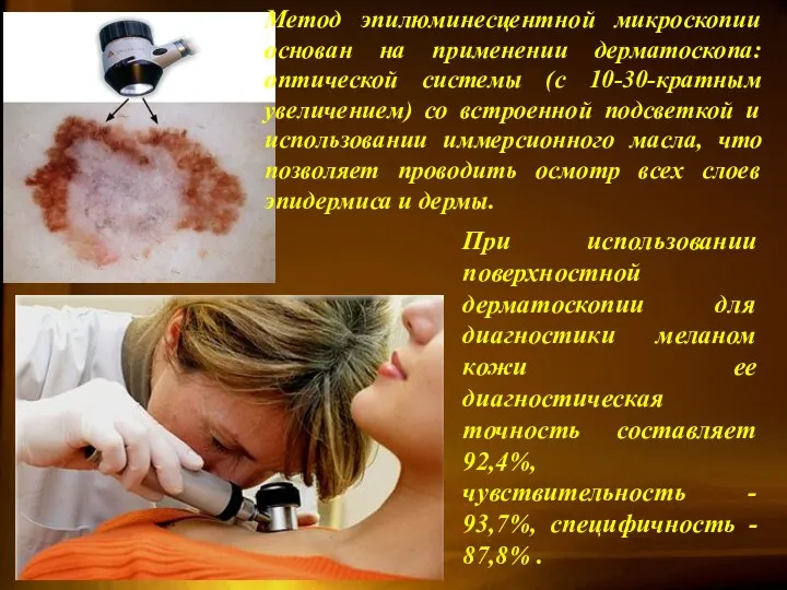 При использовании поверхностной дерматоскопии для диагностики меланом кожи ее диагностическая