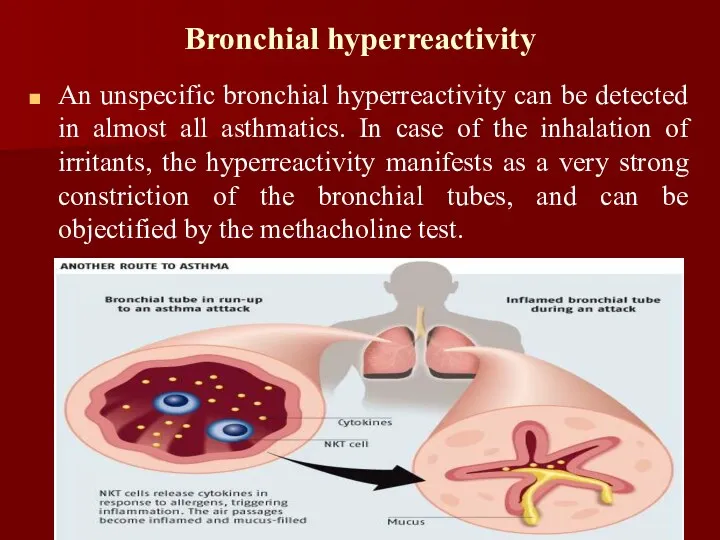 Bronchial hyperreactivity An unspecific bronchial hyperreactivity can be detected in