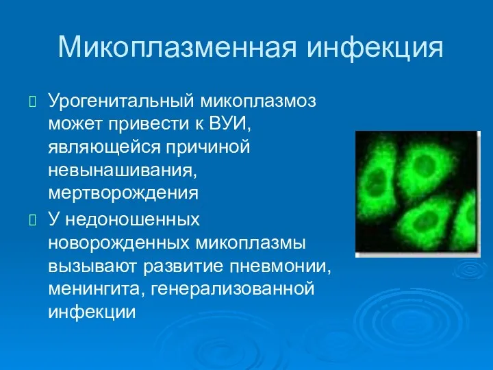 Микоплазменная инфекция Урогенитальный микоплазмоз может привести к ВУИ, являющейся причиной