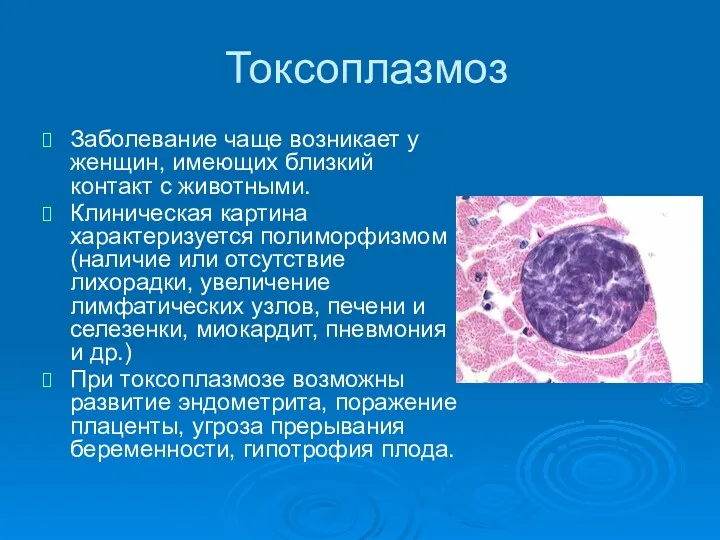 Токсоплазмоз Заболевание чаще возникает у женщин, имеющих близкий контакт с