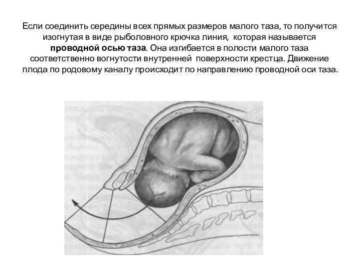 Если соединить середины всех прямых размеров малого таза, то получится