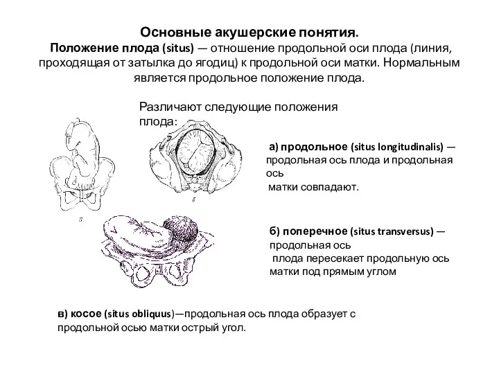 Основные акушерские понятия. Положение плода (situs) — отношение продольной оси