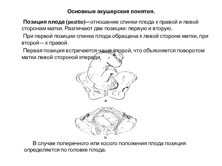 Основные акушерские понятия. Позиция плода (positio)—отношение спинки плода к правой