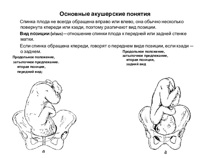 Основные акушерские понятия Спинка плода не всегда обращена вправо или