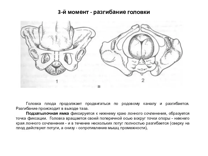 3-й момент - разгибание головки Головка плода продолжает продвигаться по