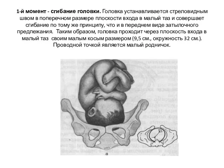 1-й момент - сгибание головки. Головка устанавливается стреловидным швом в