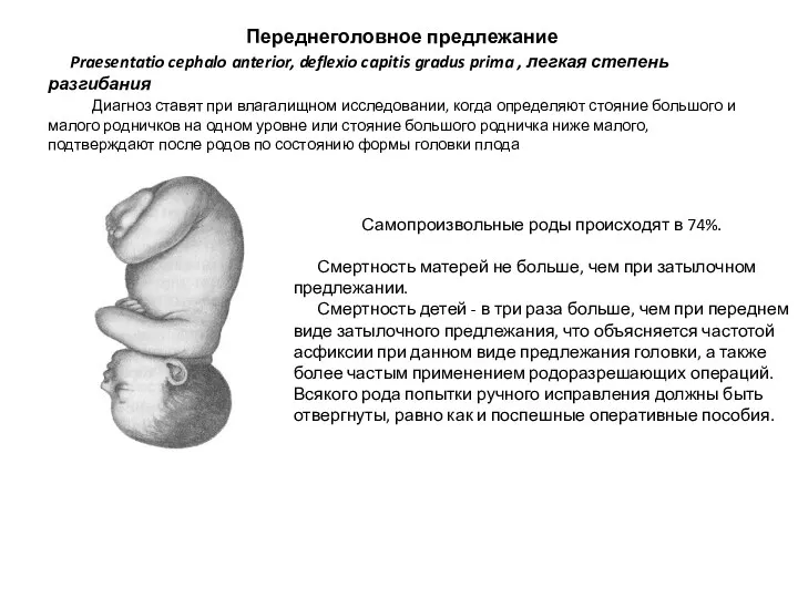 Переднеголовное предлежание Praesentatio cephalo anterior, deflexio capitis gradus prima ,