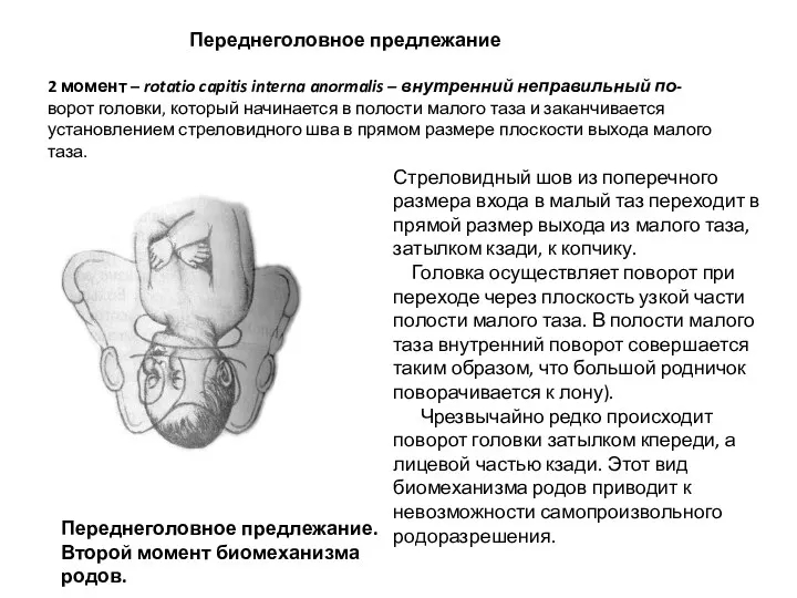 Переднеголовное предлежание 2 момент – rotatio capitis interna anormalis –