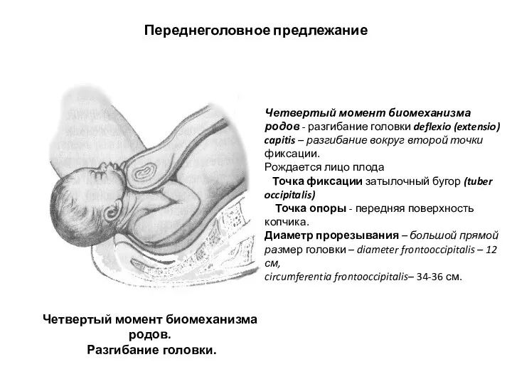 Переднеголовное предлежание Четвертый момент биомеханизма родов - разгибание головки deflexio