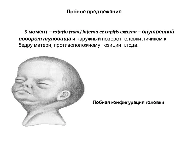 Лобное предлежание 5 момент – rotatio trunci interna et capitis