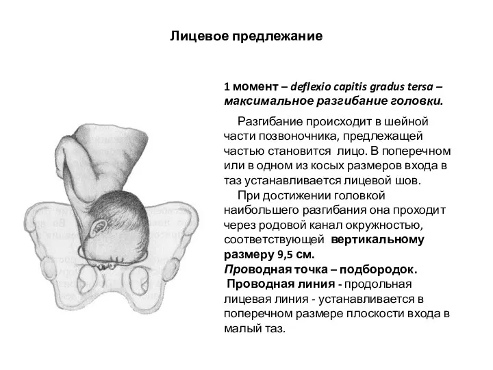 Лицевое предлежание 1 момент – deflexio capitis gradus tersa –
