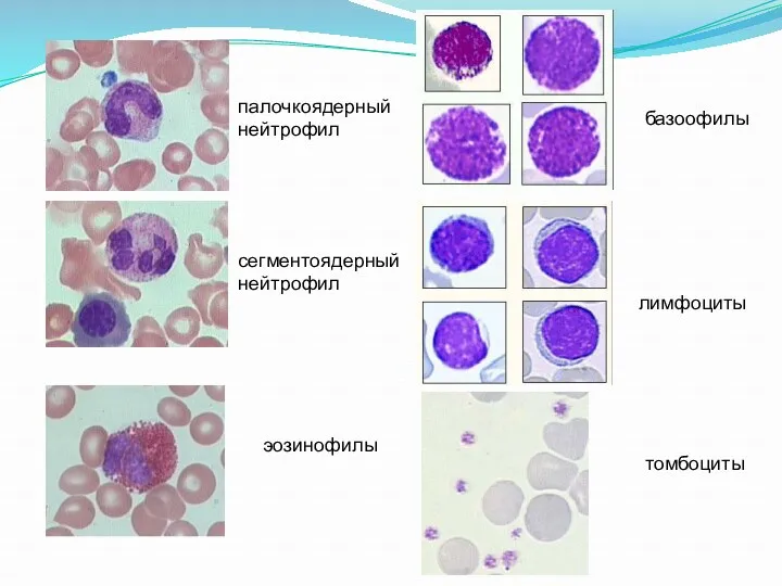 сегментоядерный нейтрофил палочкоядерный нейтрофил эозинофилы базоофилы лимфоциты томбоциты