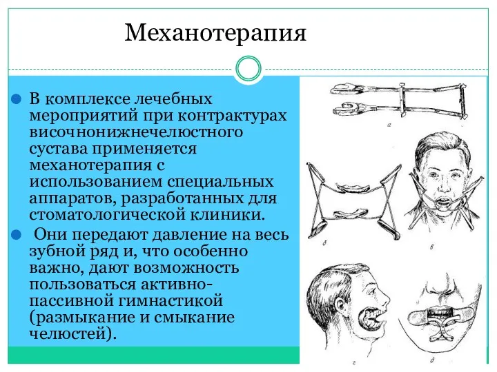 В комплексе лечебных мероприятий при контрактурах височнонижнечелюстного сустава применяется механотерапия