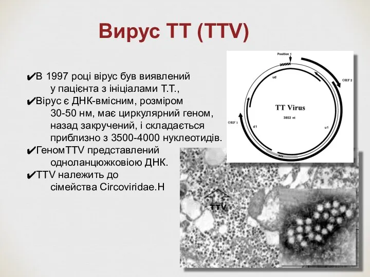 Bирус TT (TTV) В 1997 році вірус був виявлений у