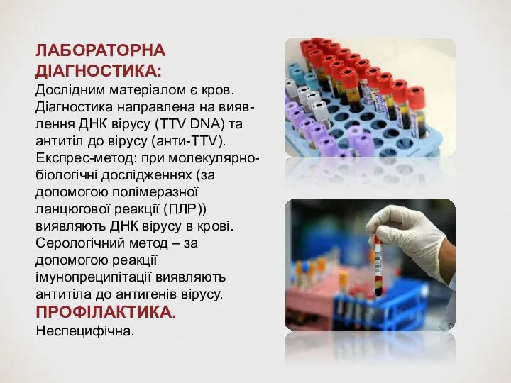 ЛАБОРАТОРНА ДІАГНОСТИКА: Дослідним матеріалом є кров. Діагностика направлена на вияв-лення