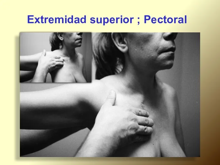 Extremidad superior ; Pectoral