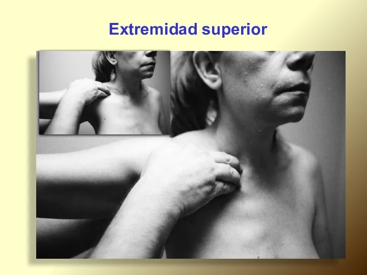 Extremidad superior