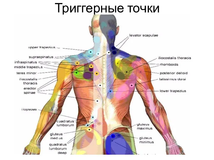 Триггерные точки