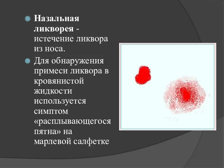 Назальная ликворея - истечение ликвора из носа. Для обнаружения примеси