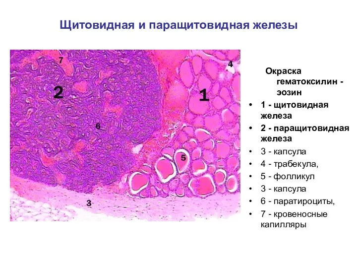 Щитовидная и паращитовидная железы Окраска гематоксилин - эозин 1 - щитовидная железа 2