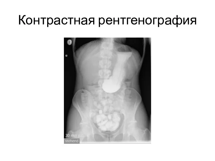 Контрастная рентгенография