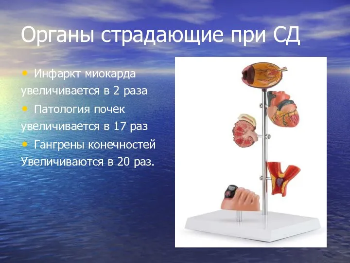 Органы страдающие при СД Инфаркт миокарда увеличивается в 2 раза