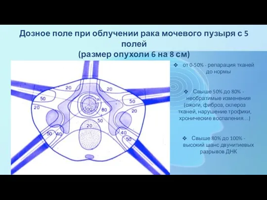 Дозное поле при облучении рака мочевого пузыря с 5 полей