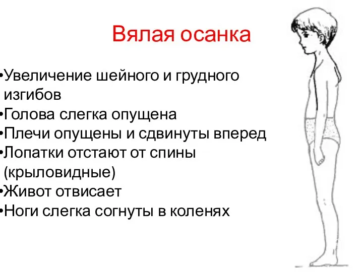 Вялая осанка Увеличение шейного и грудного изгибов Голова слегка опущена