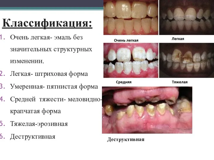 Классификация: Очень легкая- эмаль без значительных структурных изменении. Легкая- штриховая