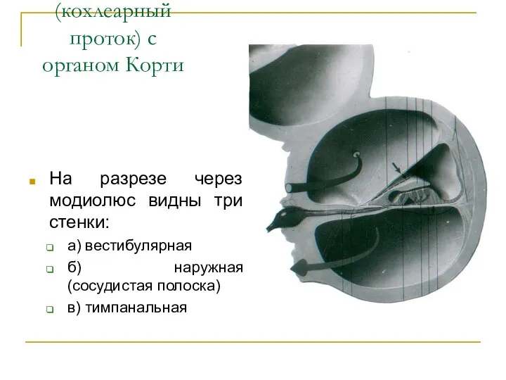 Перепончатая улитка (кохлеарный проток) с органом Корти На разрезе через модиолюс видны три