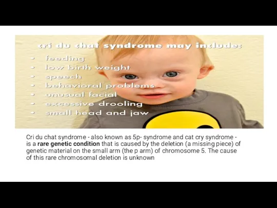Cri du chat syndrome - also known as 5p- syndrome