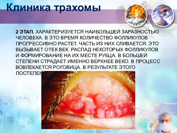 2 ЭТАП. ХАРАКТЕРИЗУЕТСЯ НАИБОЛЬШЕЙ ЗАРАЗНОСТЬЮ ЧЕЛОВЕКА. В ЭТО ВРЕМЯ КОЛИЧЕСТВО