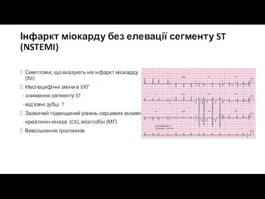 Інфаркт міокарду без елевації сегменту ST (NSTEMI) Симптоми, що вказують