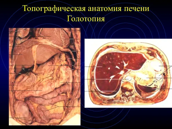 Топографическая анатомия печени Голотопия