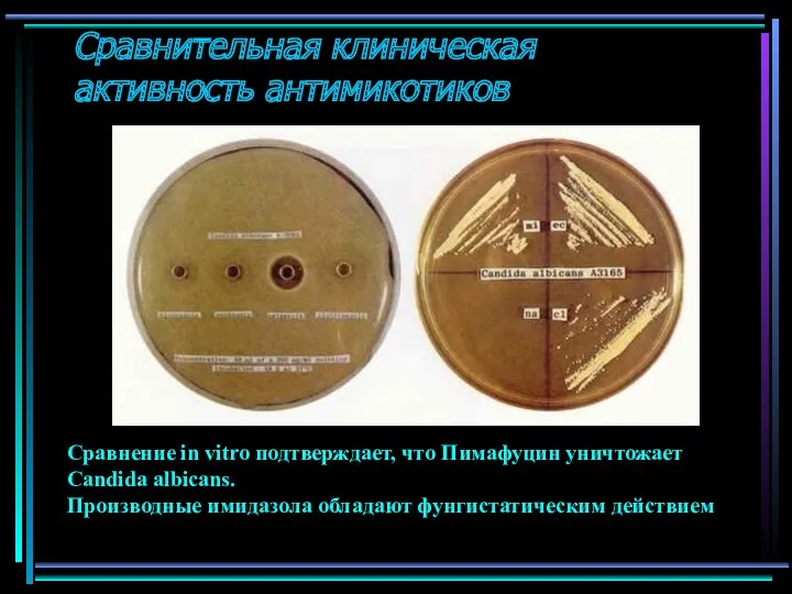 Сравнительная клиническая активность антимикотиков Сравнение in vitro подтверждает, что Пимафуцин