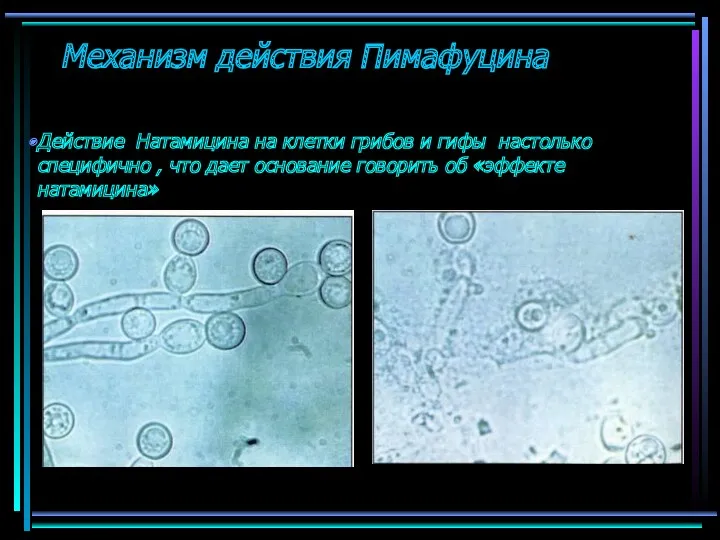 Механизм действия Пимафуцина Действие Натамицина на клетки грибов и гифы