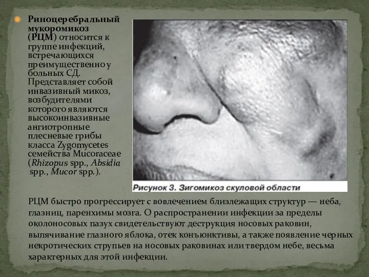 Риноцеребральный мукоромикоз (РЦМ) относится к группе инфекций, встречающихся преимущественно у