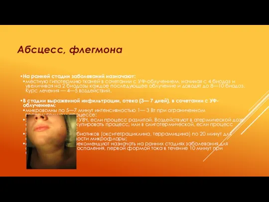 Абсцесс, флегмона На ранней стадии заболеваний назначают: местную гипотермию тканей