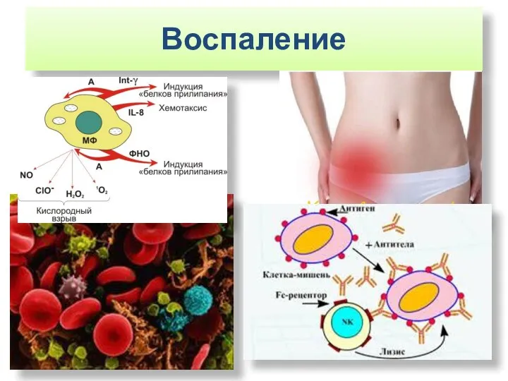 Воспаление