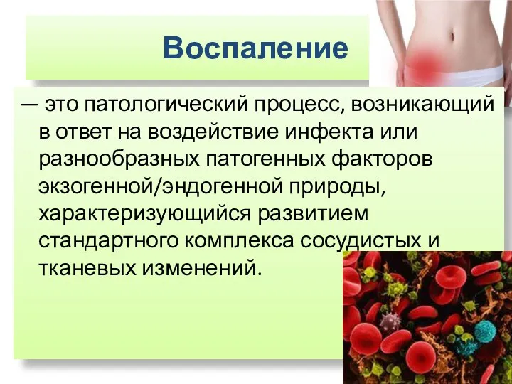 Воспаление — это патологический процесс, возникающий в ответ на воздействие