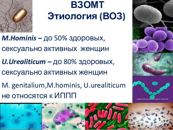 ВЗОМТ Этиология (ВОЗ) M.Hominis – до 50% здоровых, сексуально активных