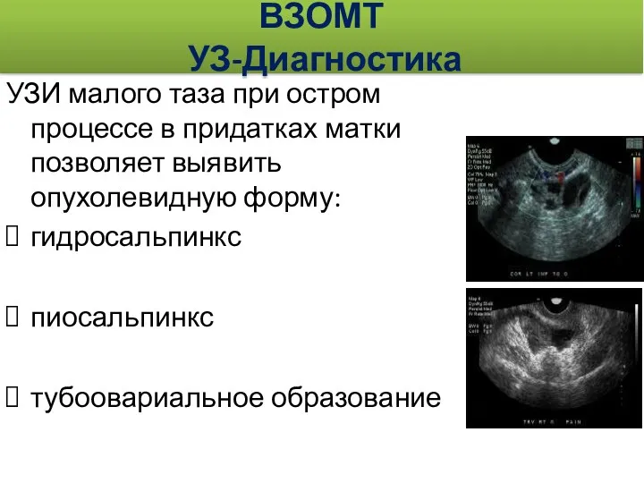 ВЗОМТ УЗ-Диагностика УЗИ малого таза при остром процессе в придатках