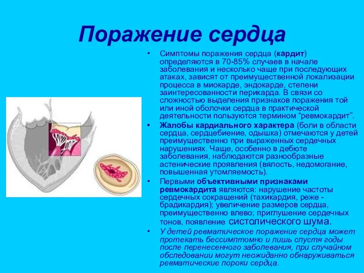 Поражение сердца Симптомы поражения сердца (кардит) определяются в 70-85% случаев